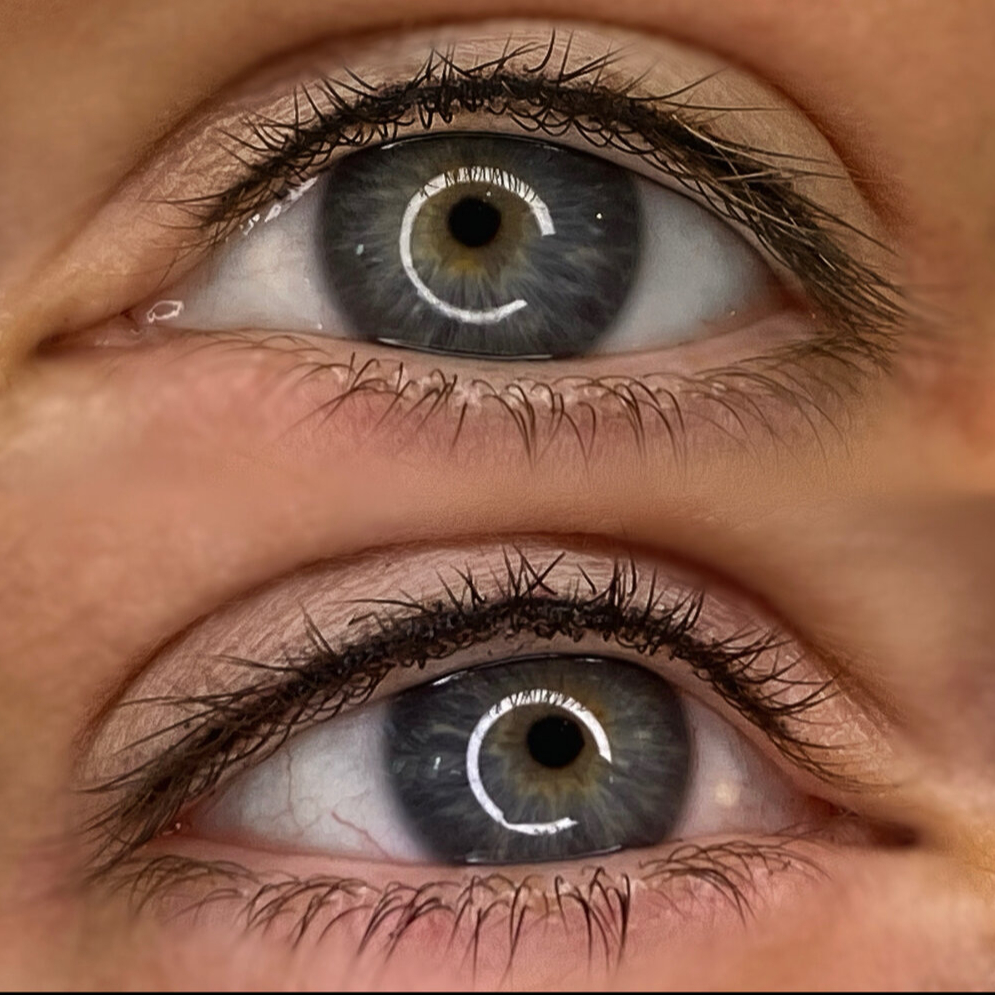 Oční meziřasové linky horní i dolní