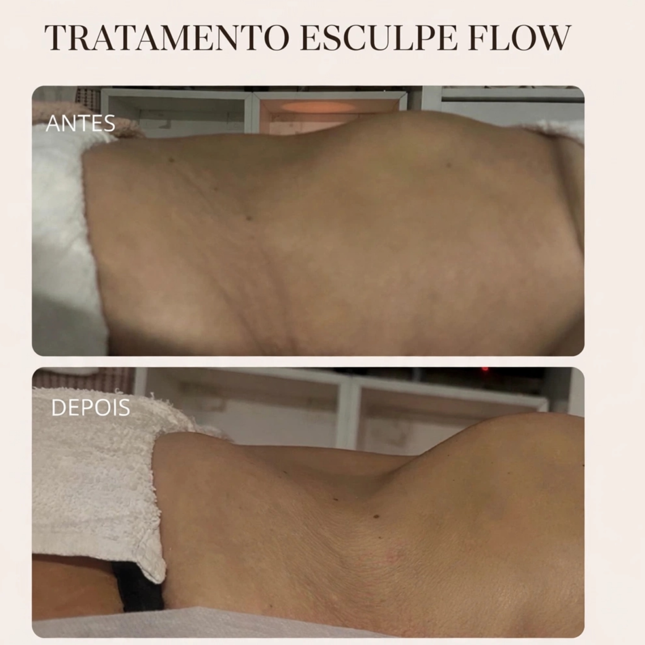 MASSAGEM ESCULPE FLOW ✨- (55min)