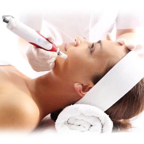 Mikrojehličkování ‑ obličej + krk