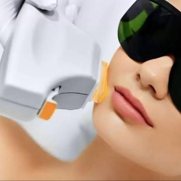 IPL Fotoomlazení - obličej