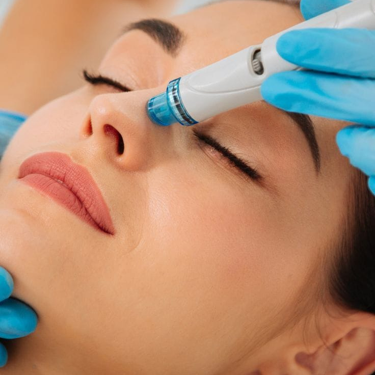 Hidradermabrasion