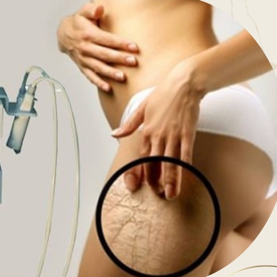 ELEKTROPORACE POSTÍŽENÉHO MÍSTA