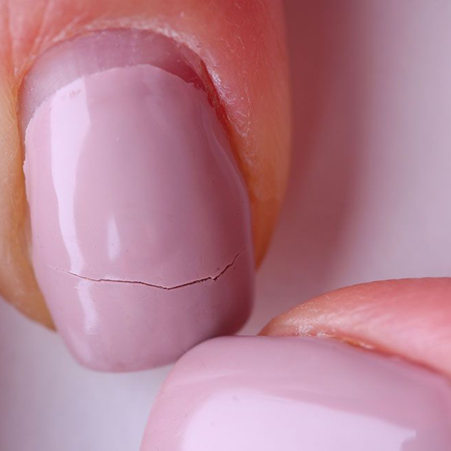 Riparazione 1 Unghia Semipermanente