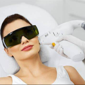 Depilação Laser SHR Rosto Completo Testa + Nariz + Buço + Maça