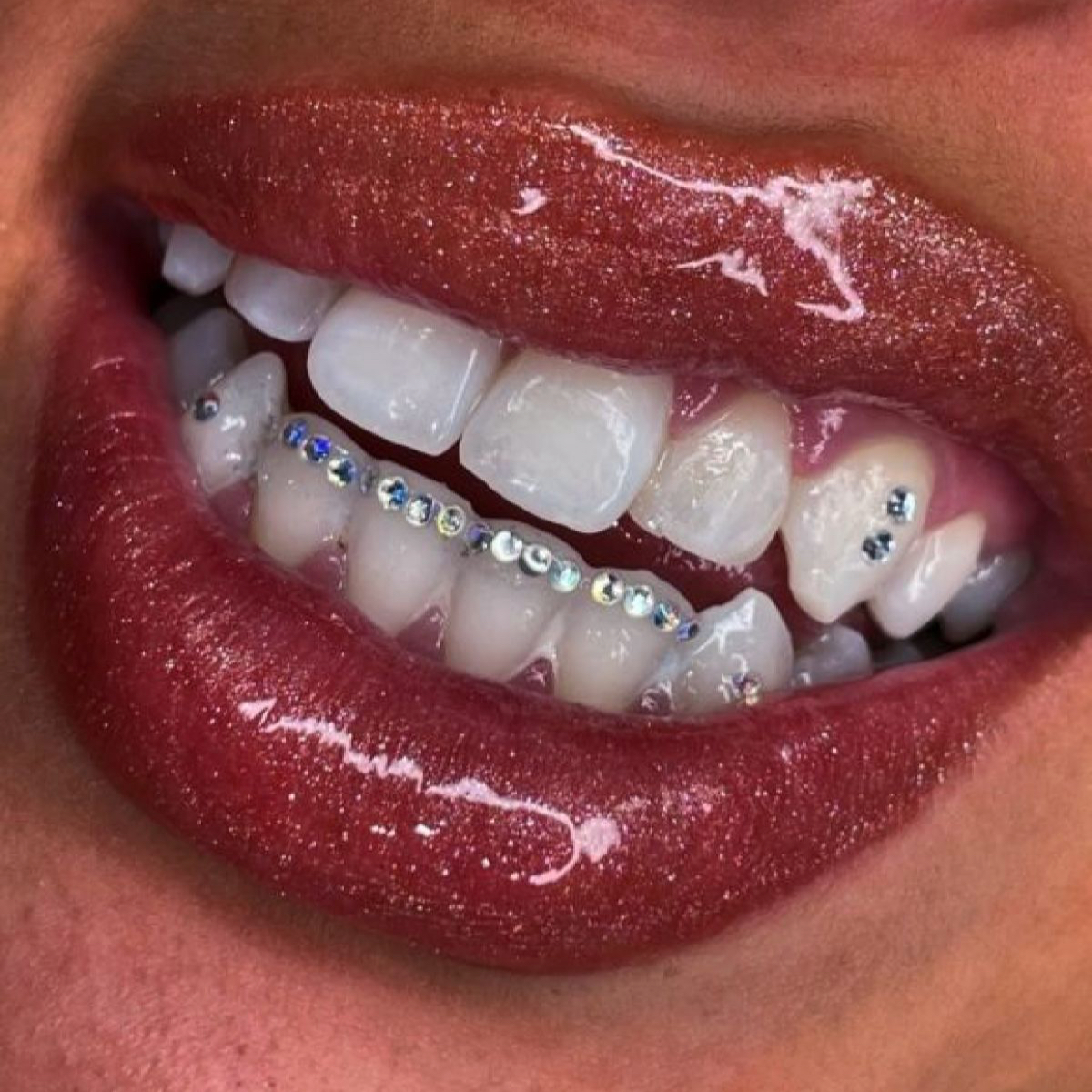 Autre compo sur devis