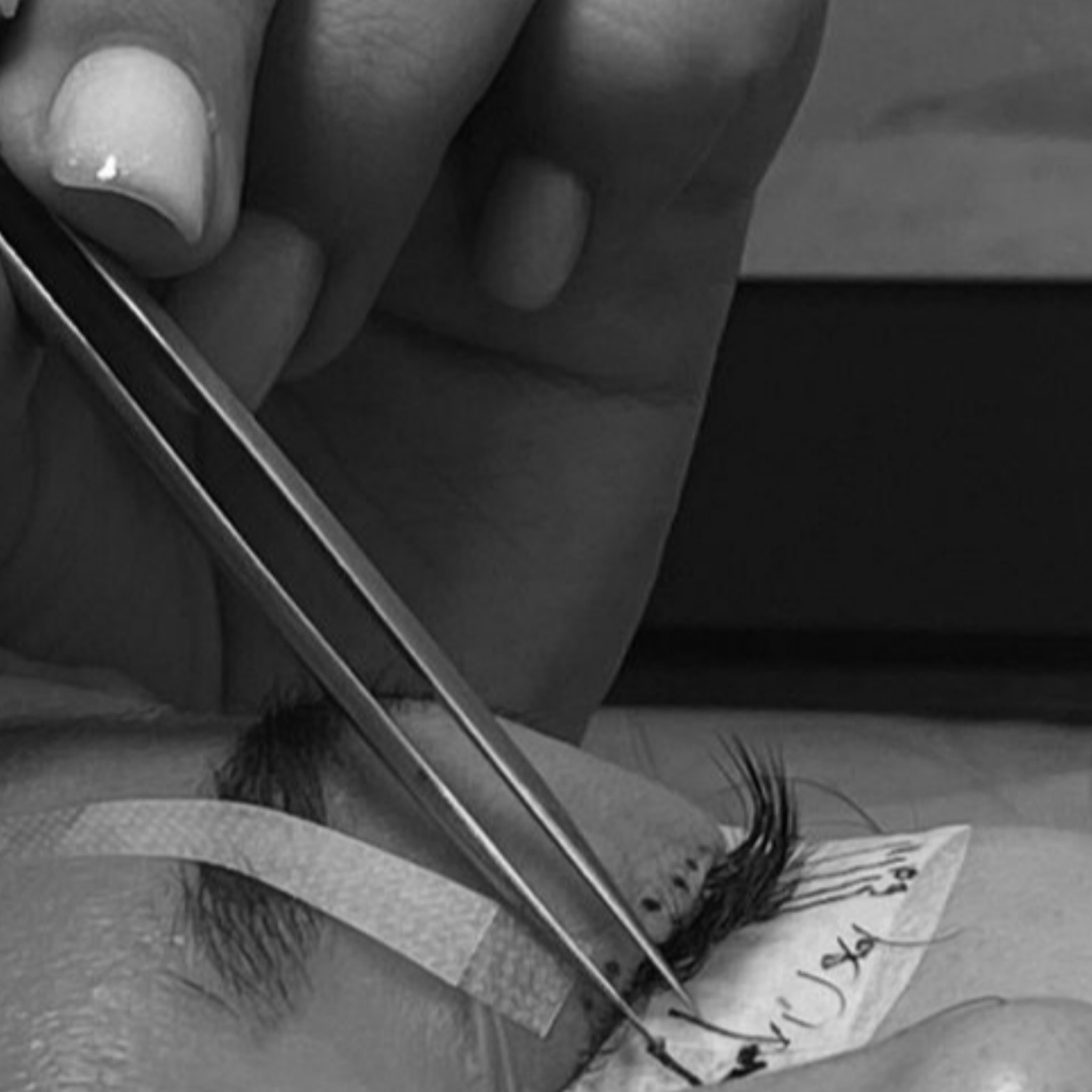 Remplissage pose simple