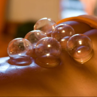 Baňková masáž 30min