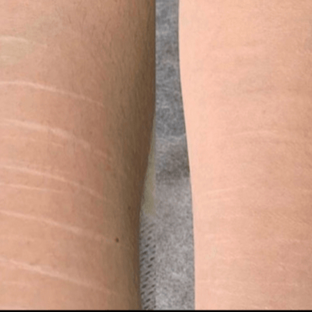 Hegelfedő tetoválás