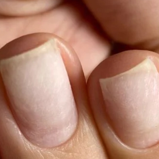 dépose total (soins des cuticules)