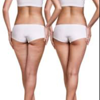 Tui Na minceur ( jambes) + Réflexologie plantaire