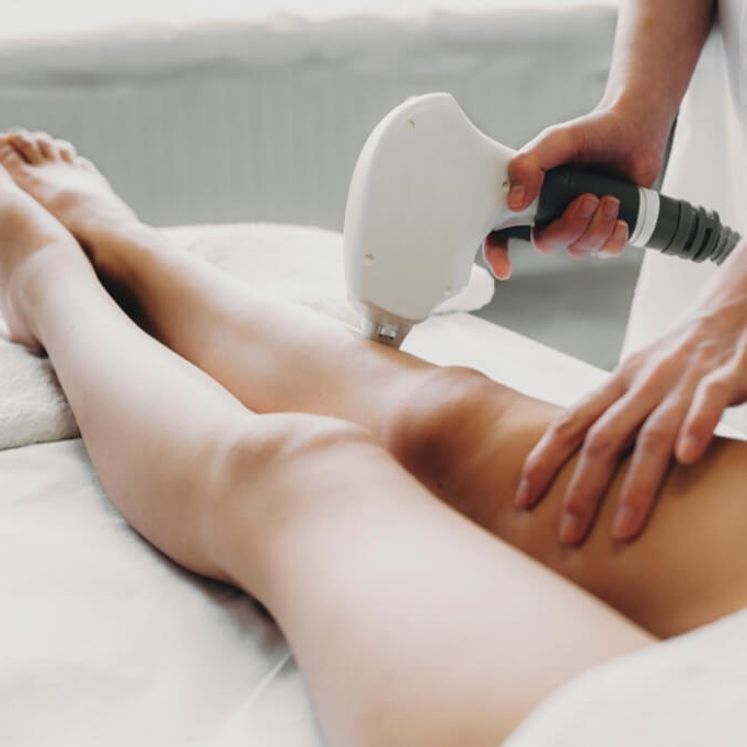 Laserová epilace - L