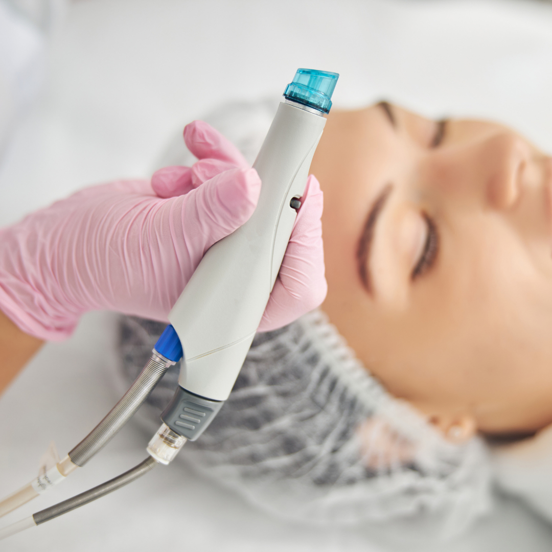 Hydrodermabraze – Aqua Renewal (100 min)