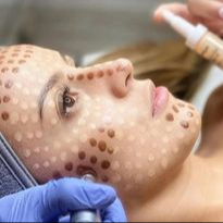 BB Glow - sérum dle typu pleti + barevná séra 70min.