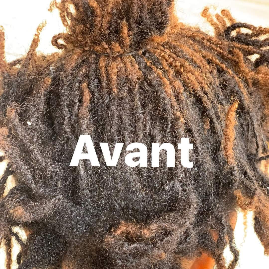 Resserrages microlocks(NB:Plus de 8 semaines, supplément de 30€)