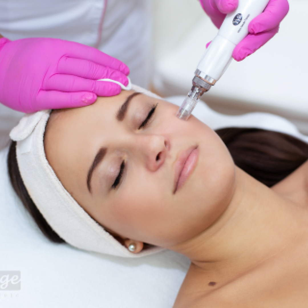 Mikrojehličkování / mezoterapie obličeje