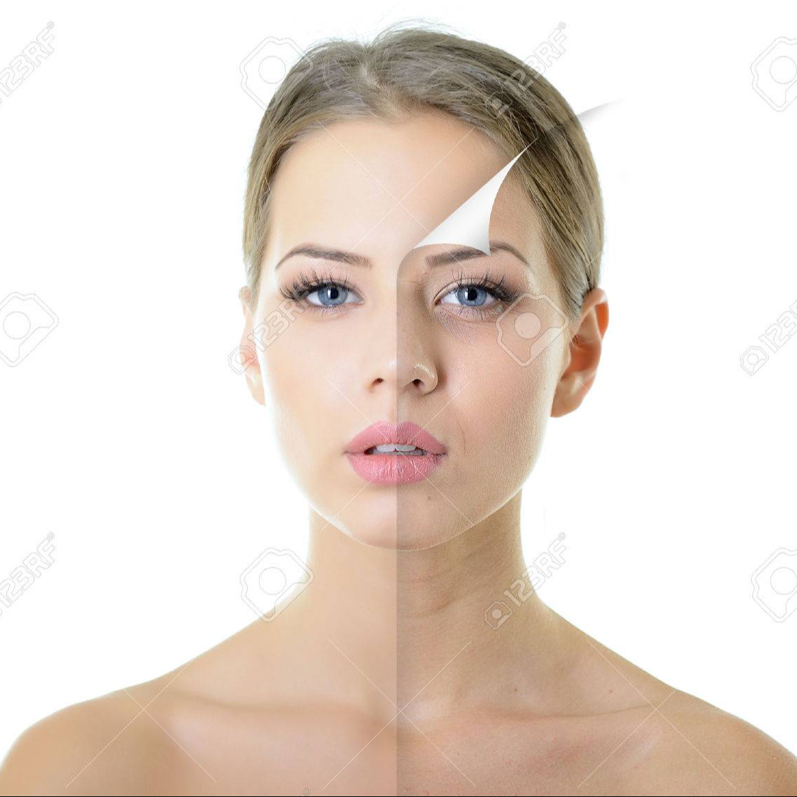 Ošetrenie - peeling 40% kyselinou mandľovou