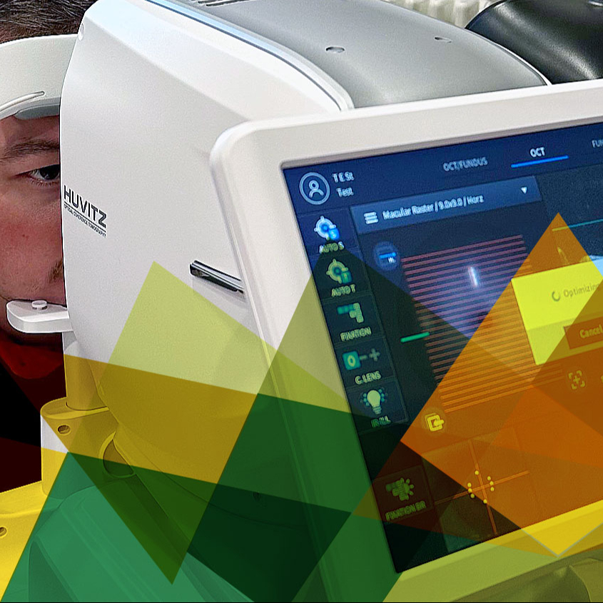 OCT - Optická koherentní tomografie