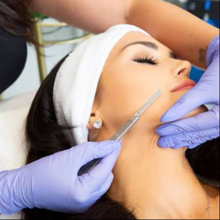 DERMAPLANING