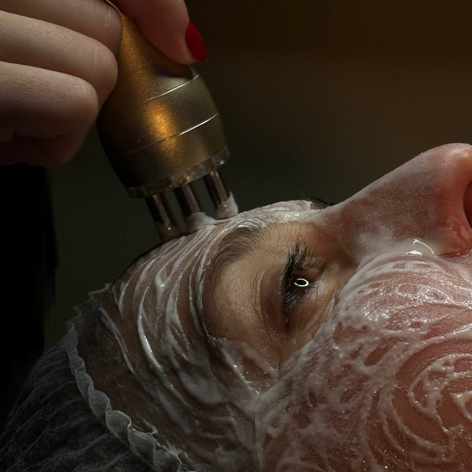 Liftingové ošetřeni GIGI Bioplasma + zdarma 30min přístrojový RF