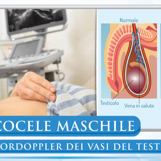 Visita urologica + Doppler Testicolare (Scrotale)