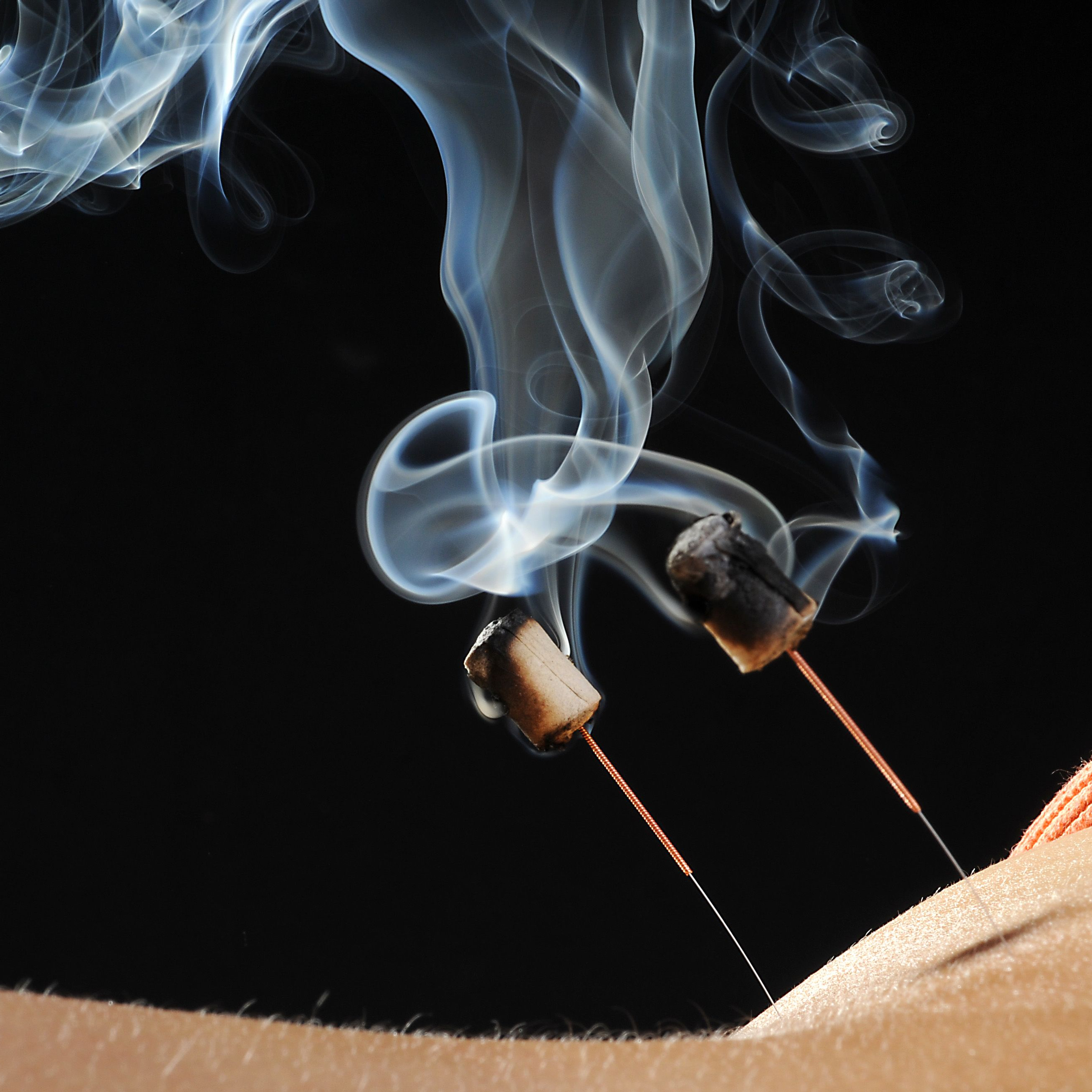 Akupunktur lang (90 Min.)