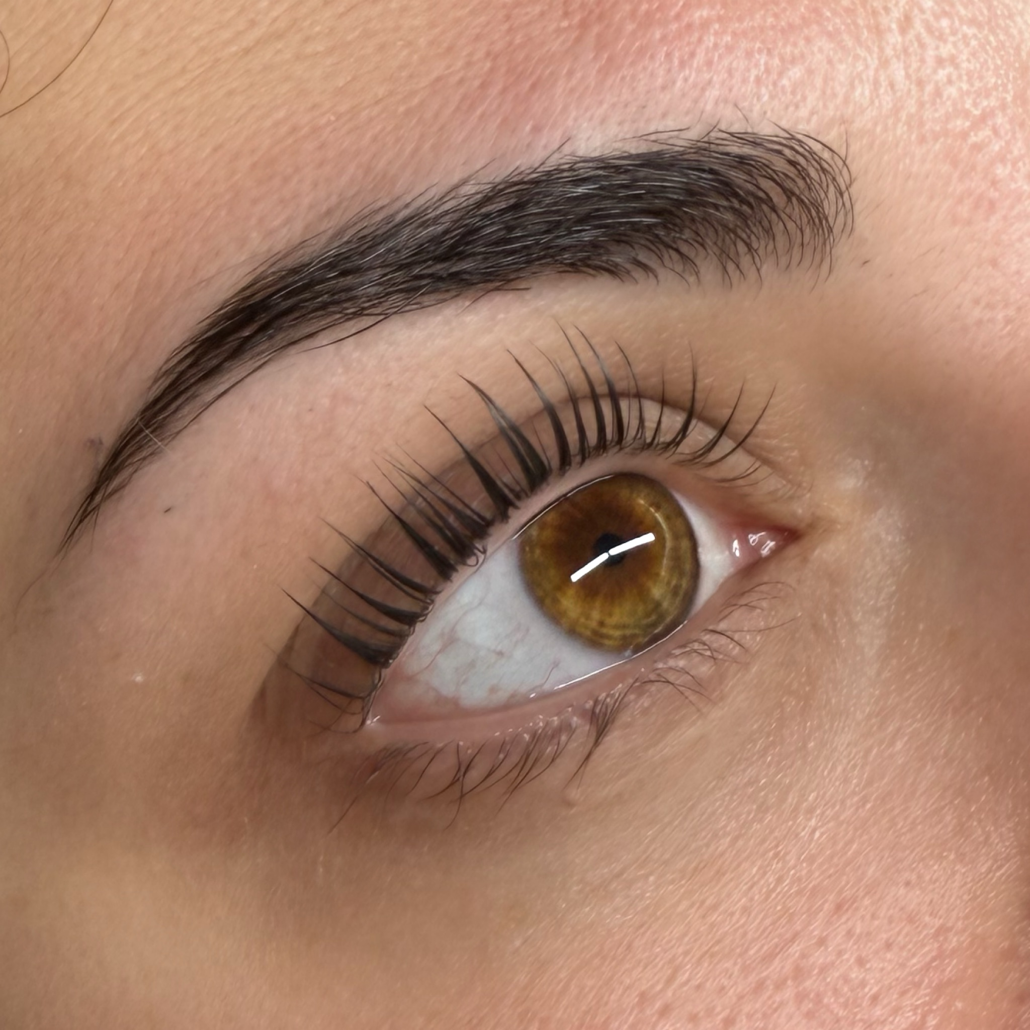 Duo Essentiel - Rehaussement + restructuration