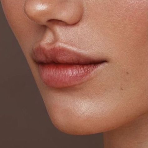 1 Zone: lèvre supérieur ou menton ou joues