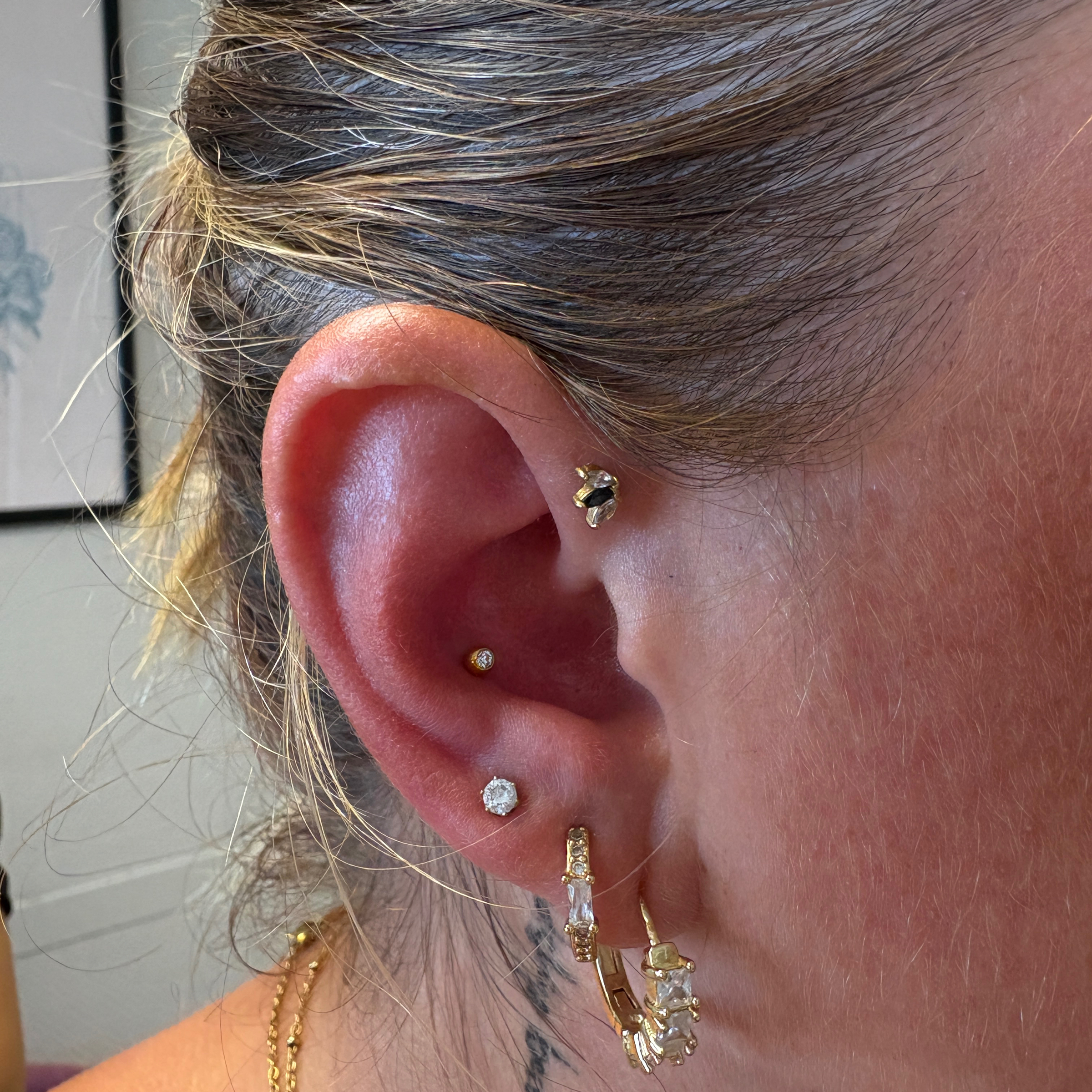 Upper lobe (3ième trou)