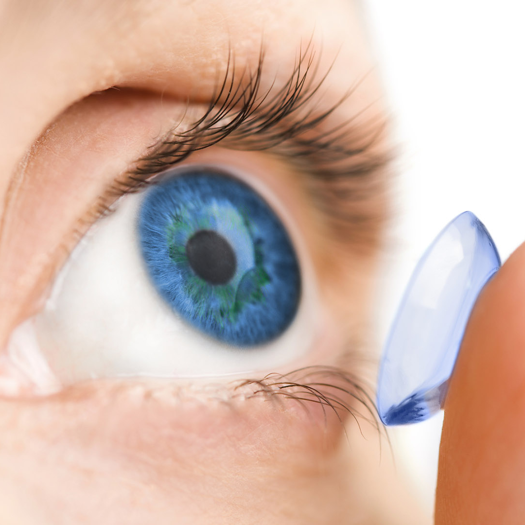 Aplikácia mäkkých kontaktných šošoviek