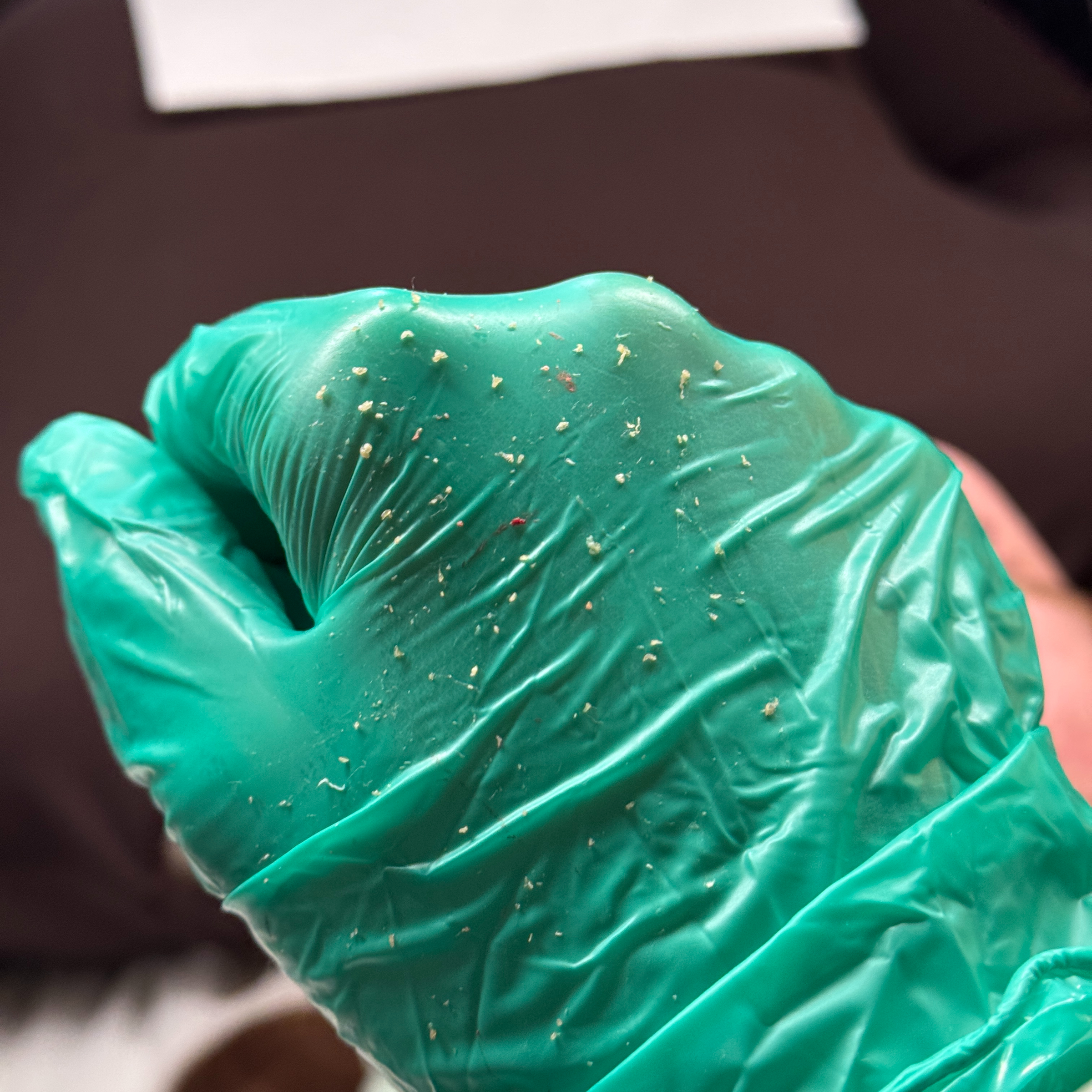 Extrakce akné - STUDENT