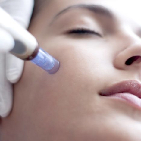 Dermapen