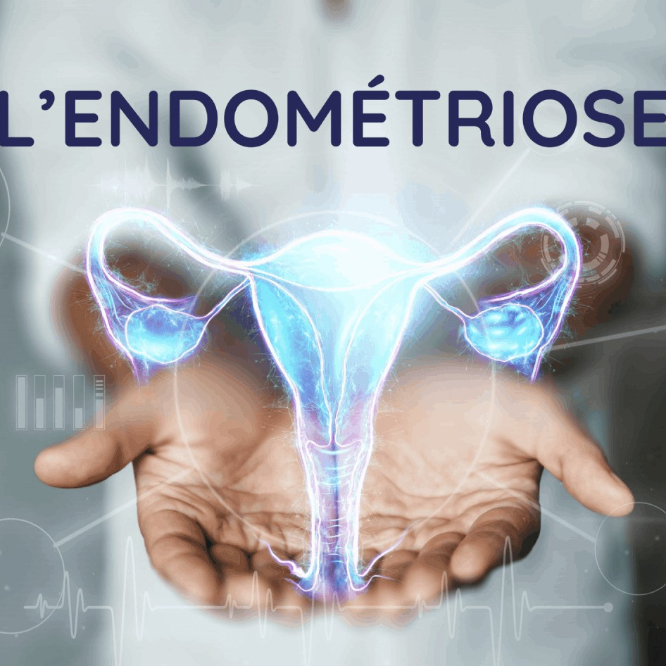 soin endometriose