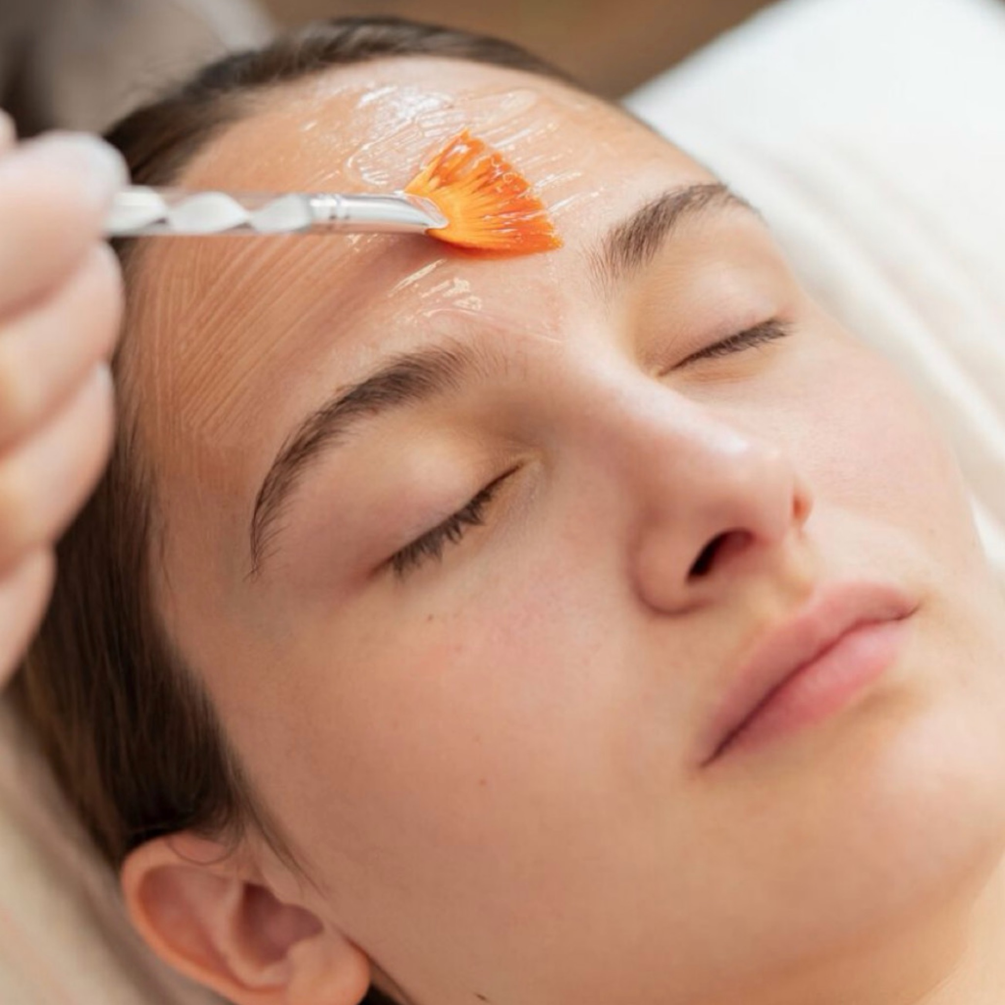 PILLING QUÍMICO FACIAL