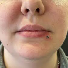 Labret décalé