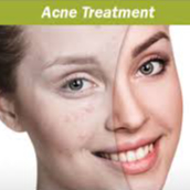 ACNE BEHANDELING - HYDRA DERMA facial + OZONTHERAPIE