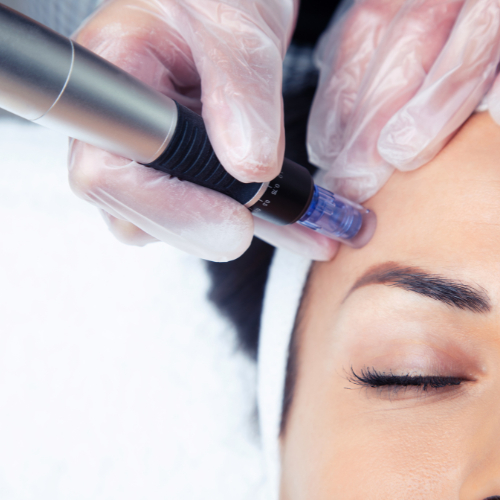 Mikrojehličkování