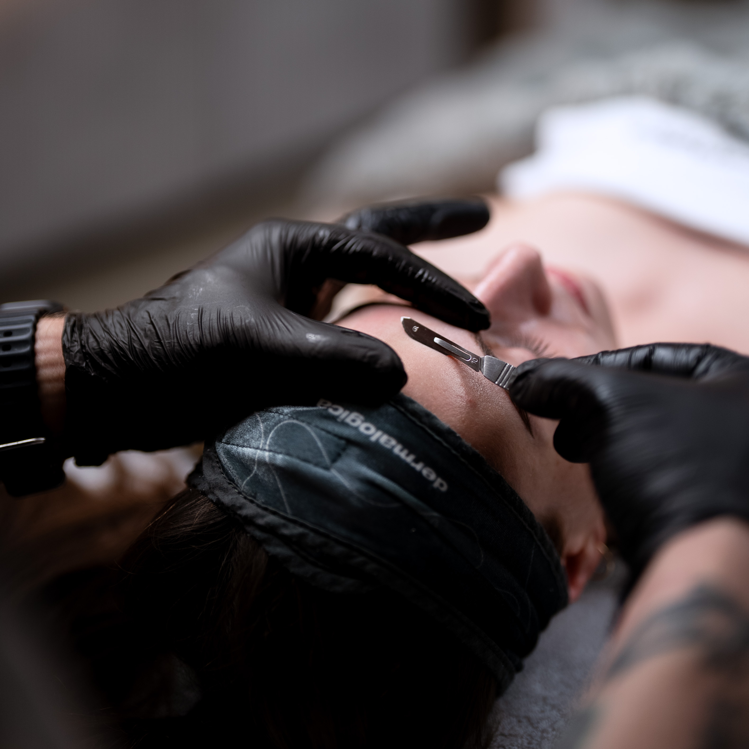 Dermaplaning