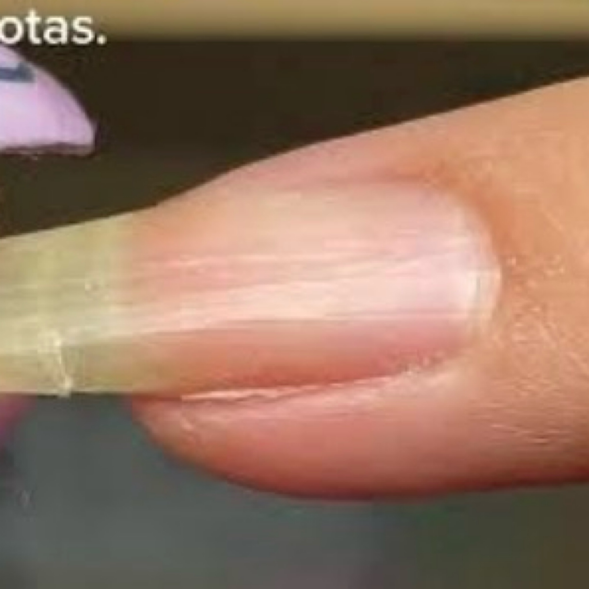 Arreglo de uña larga rota