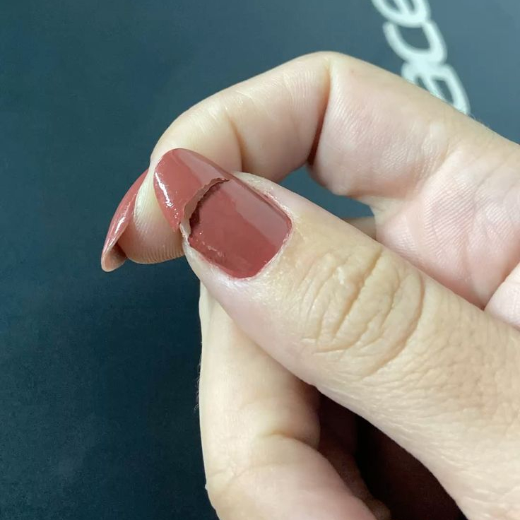 Réparation ongle