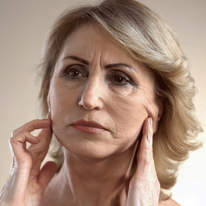 Úprava vrások celej tváre