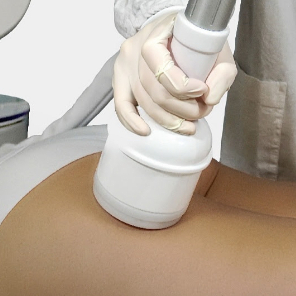 SONOBEAT - LIFTING NOHOU