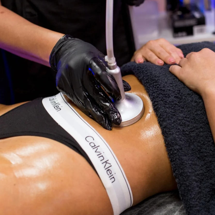 Vákuová lymfodrenážna masáž brucha