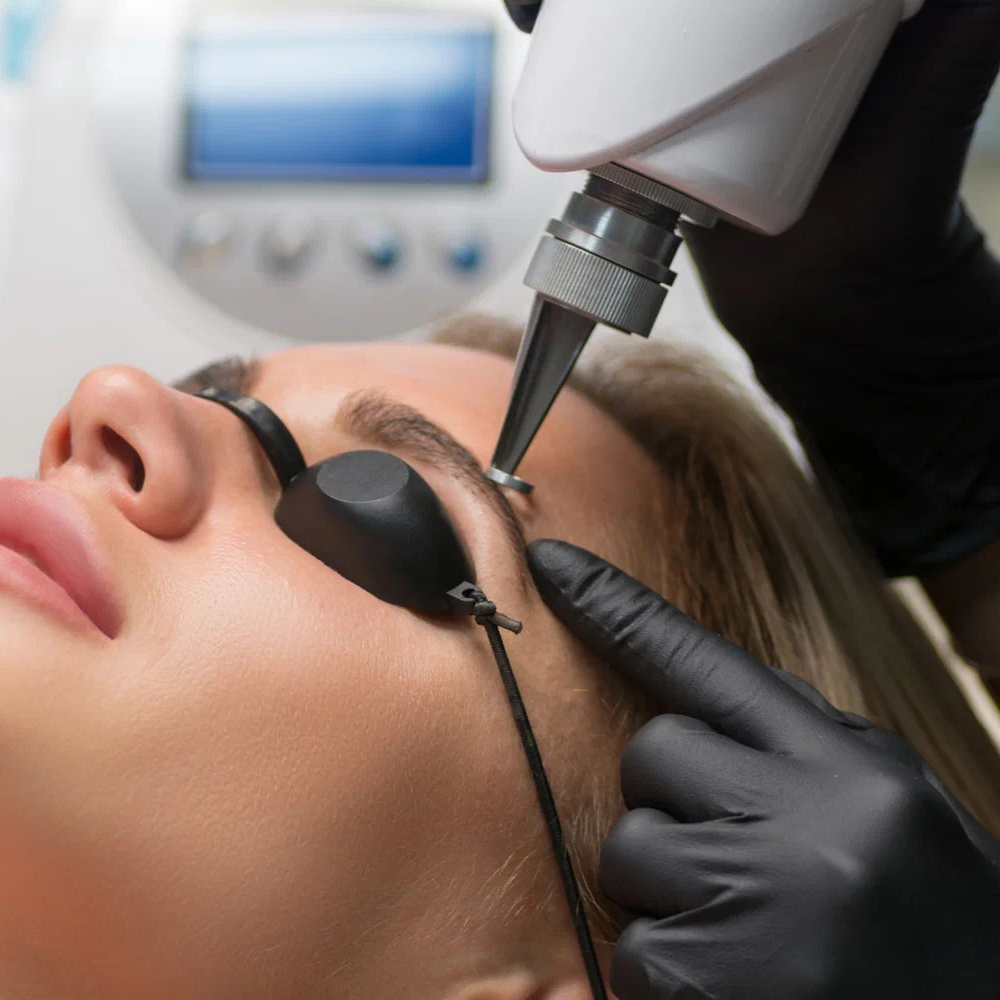 Odstranění Permanent Make-up. Olga paliy — top master. První sma