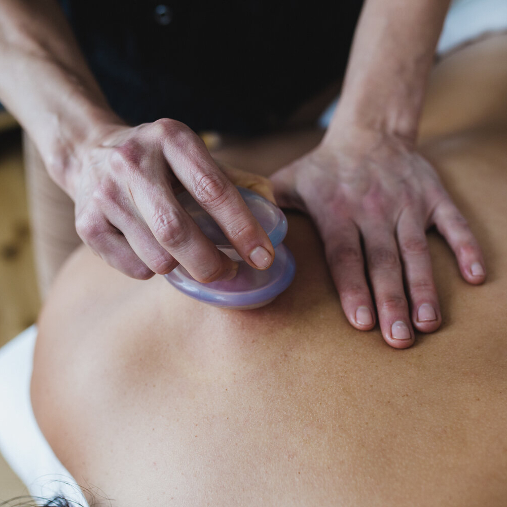 Sliding Cupping (myofasciale cupping)