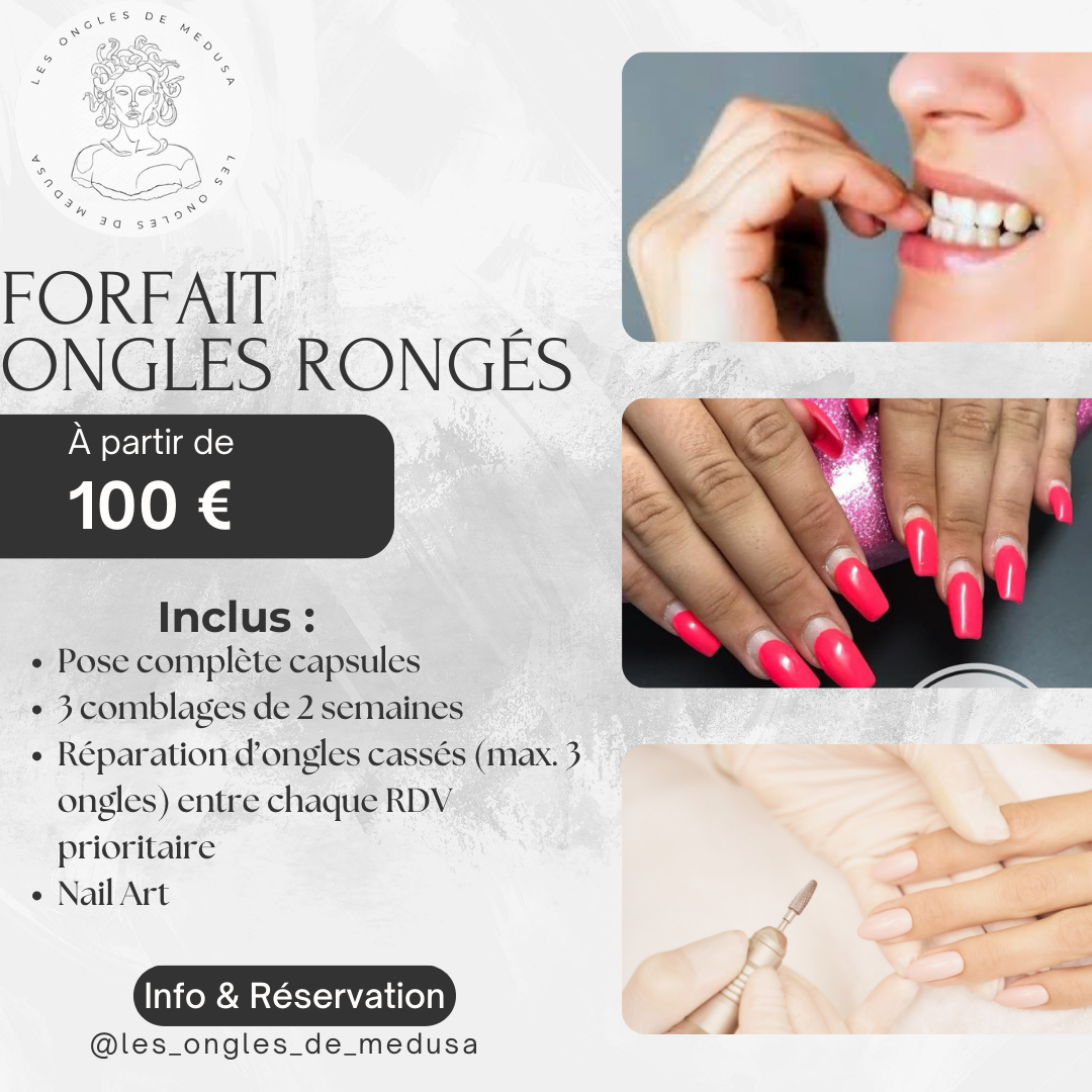 Forfait Ongles Rongés