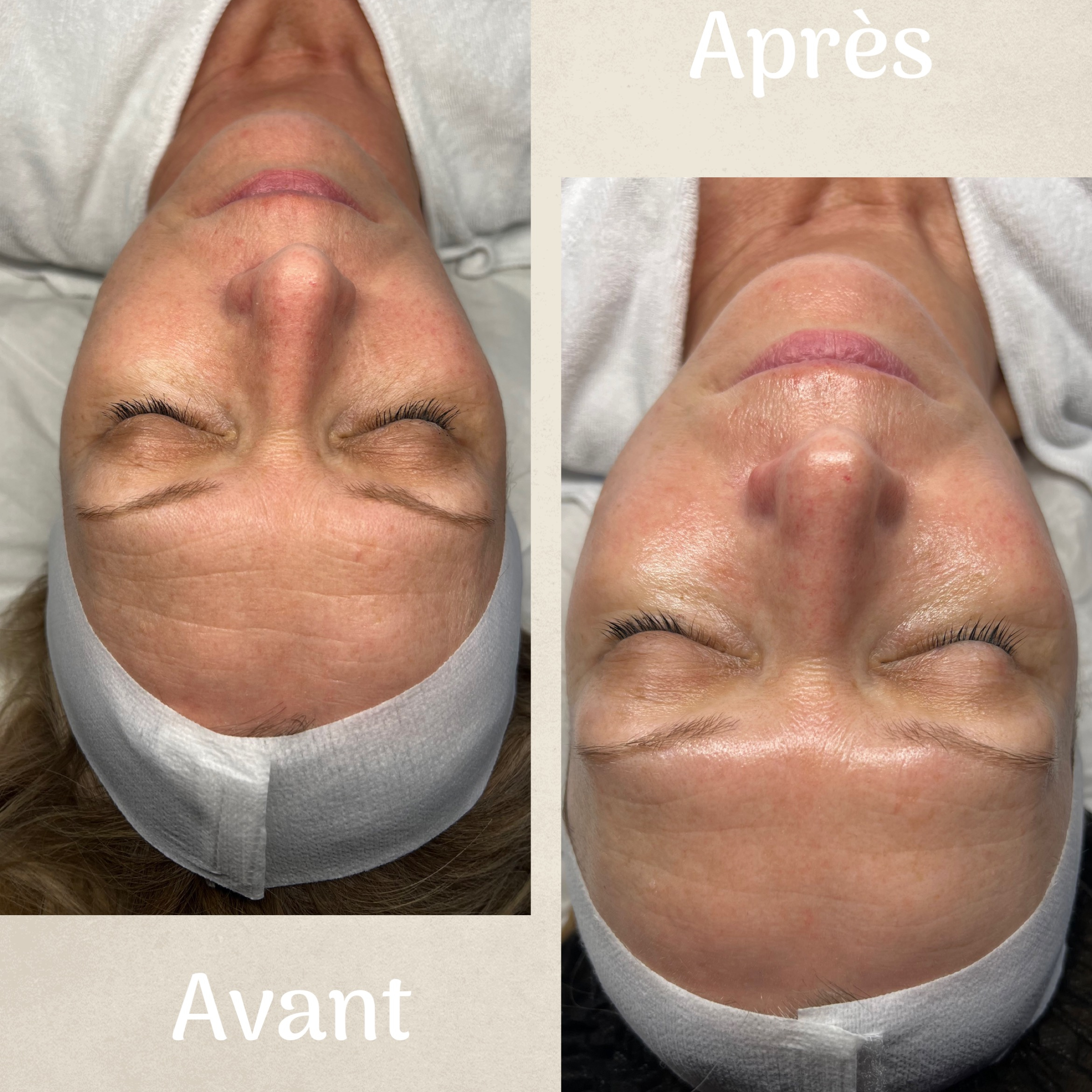 NUANCE Soin anti- âge adapté à partir de 45 ans et +