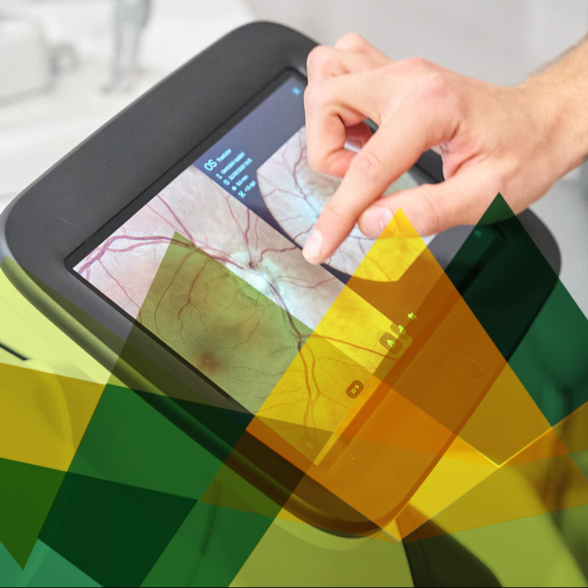 AI vyšetření sítnice