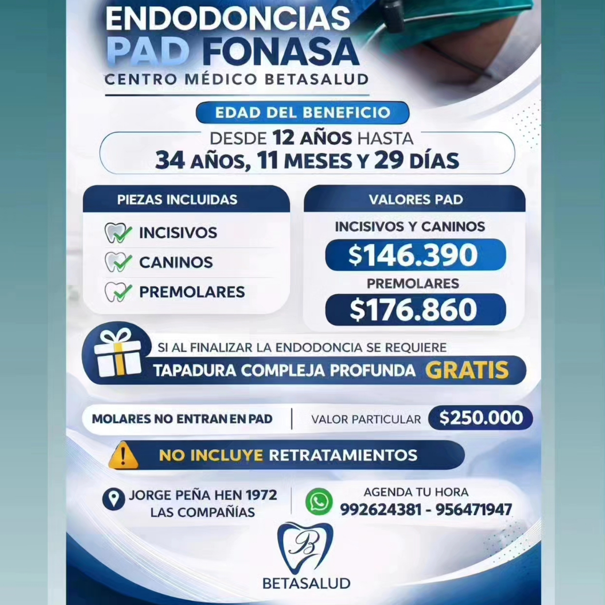 Endodoncia Mecanizada en una sola sesión en Molares