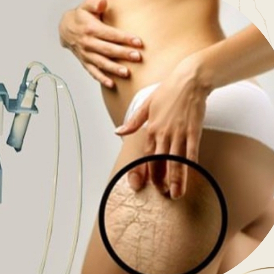 MIKROJEHLIČKOVÁNÍ POSTIŽENÉHO MÍSTA