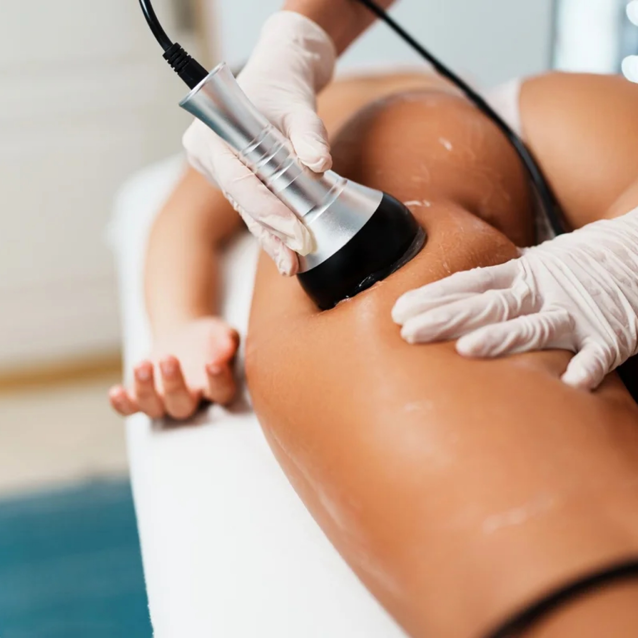 Skadi Sculpt /Body contouring benen